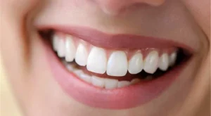 Evde Diş Beyazlatma Yöntemleri