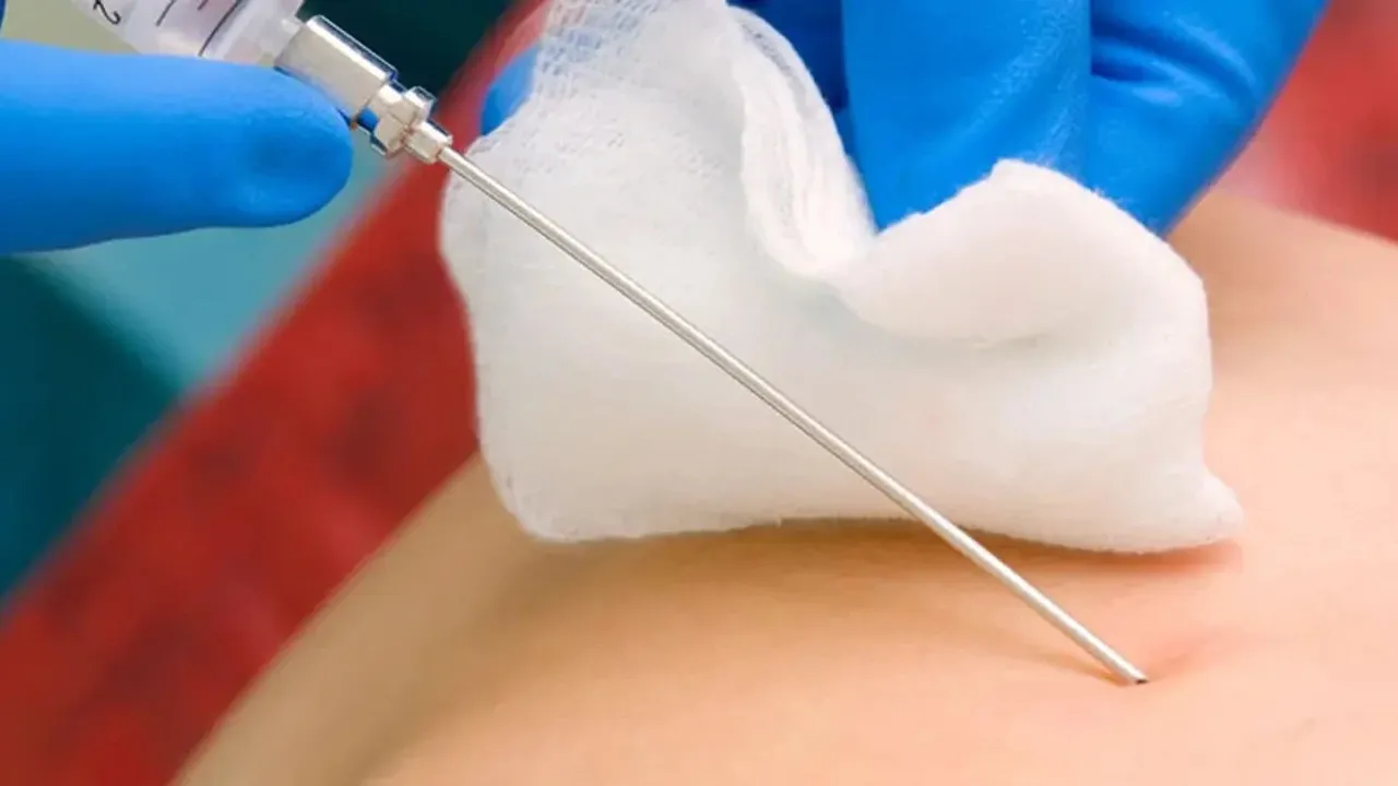 akciğer biyopsi riskleri