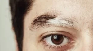 Kaş Neden Beyazlar?