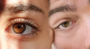 Göz Seğirmesi Nasıl Geçer?