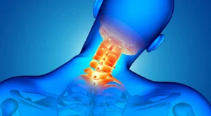 Boyun Düzleşmesi Nedir? Nasıl Geçer?